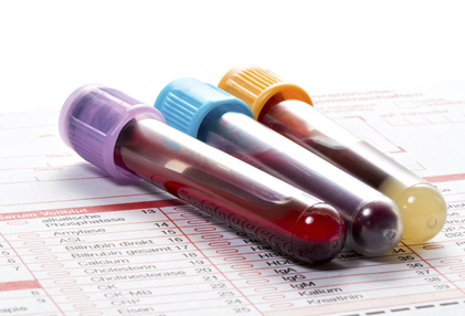 Xét nghiệm máu giúp xác định nồng độ nhiễm độc thủy ngân. Theo nguồn: Health.harvard.edu