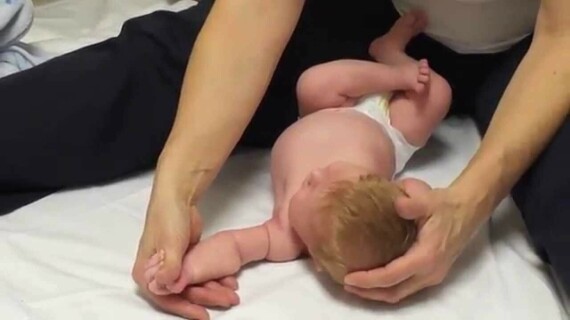 Chấn thương đám rối thần kinh cánh tay ở trẻ sơ sinh. Nguồn ảnh: physio-pedia.com