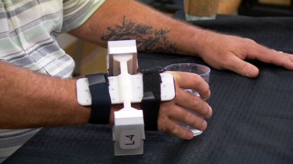 Tạ cổ tay giúp người bệnh kiểm soát run tay. Nguồn ảnh: abc30.com