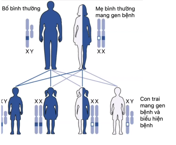 Bệnh bạch tạng ở mắt xảy ra chủ yếu ở nam do thừa hưởng gen đột biến tử mẹ   (Nguồn ảnh: https://albinismupclose.com)