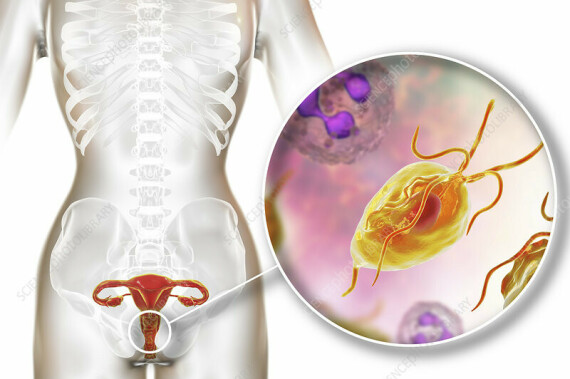 Trùng roi trichomonas gây nhiễm trùng âm đạo (https://www.sciencephoto.com/)