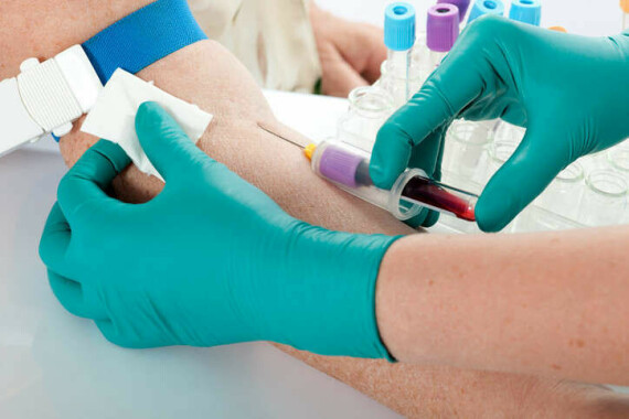 Lấy máu để làm xét nghiệm hemoglobin (Nguồn ảnh: e7health)