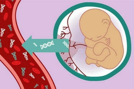  Hình: Xét nghiệm trước sinh không xâm lấn giúp sàng lọc bệnh lý bất thường nhiễm sắc thể, và tiết lộ giới tính thai nhi. Nguồn: Gen solution