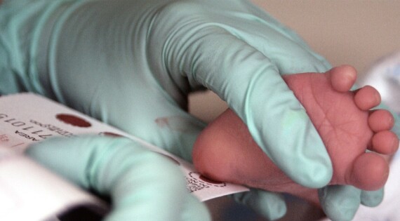 Chẩn đoán bệnh bằng xét nghiệm máu gót chân ở trẻ sơ sinh. Nguồn ảnh: wikipedia