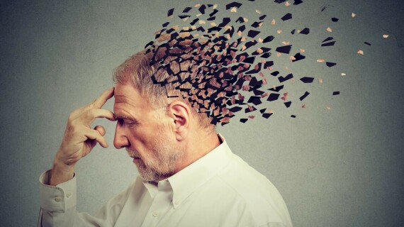 Một số bệnh lý thần kinh như Alzheimer có thể làm tăng nguy cơ bất lực ở nam giới. Nguồn ảnh: theconversation.com