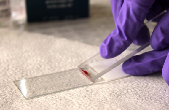 Phết máu ngoại biên giúp đánh giá số lượng và hình dạng của tế bào bạch cầu, hồng cầu và tiểu cầu. Nguồn ảnh: Agric.wa.gov.au