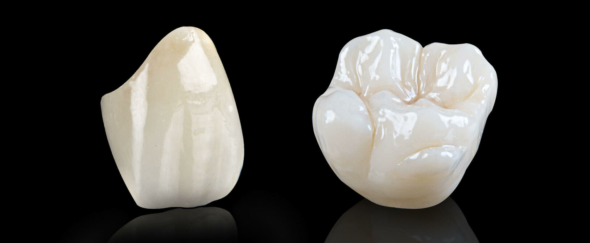 Chụp răng zirconia. Nguồn ảnh: Familydentistry.com