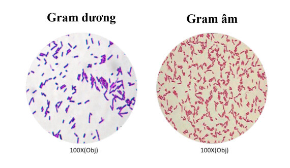 Hình ảnh nhuộm gram của 2 loại vi khuẩn là khác nhau, nguồn ảnh chegg.com