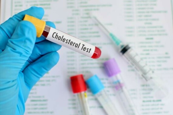 Nên định kỳ kiểm tra cholesterol (Nguồn ảnh: Medcare Spain)