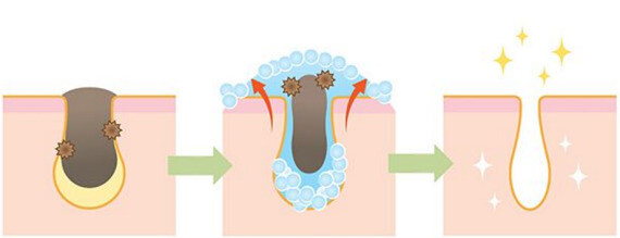 Cách BHA tẩy da chết và làm thông thoáng lỗ chân lông, nguồn www.pinterest.com
