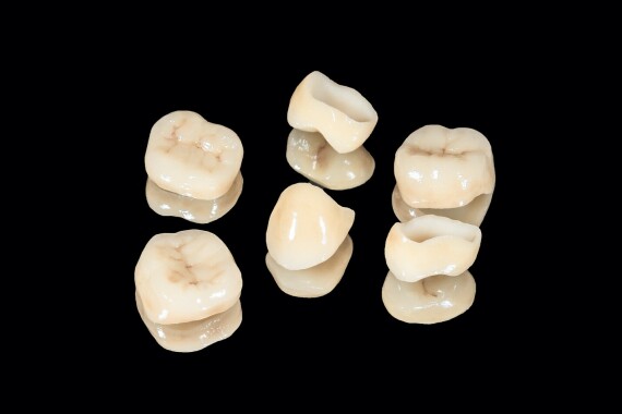 Dental Crowns Cost - Porcelain and Zirconia CrownsChụp răng zirconia. Nguồn ảnh: drarocha.com