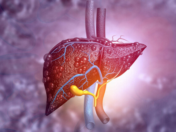 Bất kỳ bệnh lý nào ảnh hưởng đến chức năng gan đều có thể khiến mức bilirubin tăng lên trong máu. Nguồn ảnh: Timesofindia.com