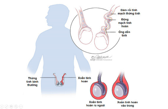 Hình ảnh giải phẫu xoắn tinh hoàn