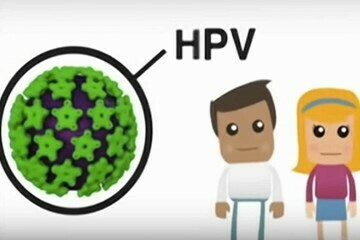 HPV lây qua tiếp xúc da-da hoặc quan hệ tình dục. Nguồn ảnh: www.healthnavigator.org.nz