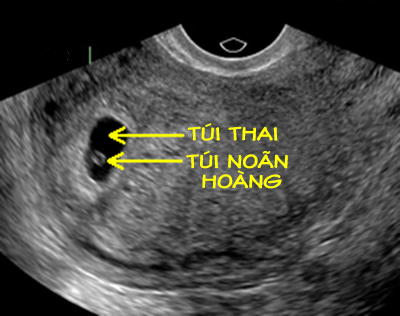 Nguồn ảnh: fertilitysmarts.com