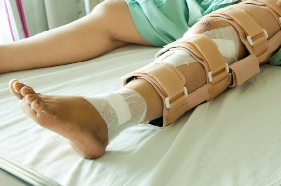 Bó bột, nẹp có thể được sử dụng để điều trị gãy xương chày nếu phẫu thuật không thích hợp.   (Nguồn ảnh medicalnewstoday.com)