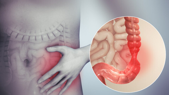 Thuốc Buscopan giúp cải thiện các cơn đau do hội chứng kích thích ruột. Nguồn ảnh: Healthline