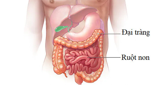 Tiêu chảy có thể xuất hiện do bất thường ở ruột non hoặc đại tràng. Nguồn ảnh: Mayoclinic.org