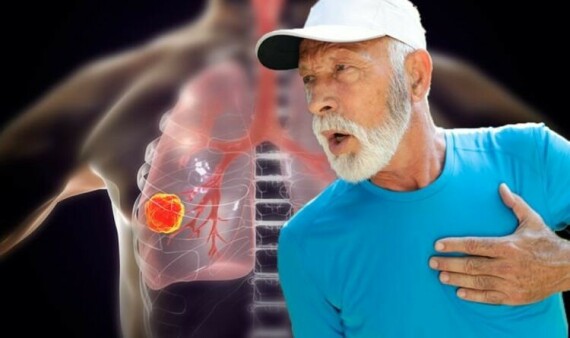 Khó thở là một trong những biểu hiện sớm của ung thư phổi. Theo nguồn: express.co.uk.
