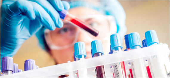 Xét nghiệm máu có thể được thực hiện nếu nghi ngờ các tình trạng tự miễn dịch khác. (nguồn: victoriavn.com)