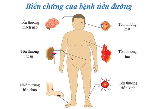 Xét nghiệm HbA1C là gì? Vai trò và ý nghĩa của HbA1C trong bệnh tiểu đường - Ảnh 2