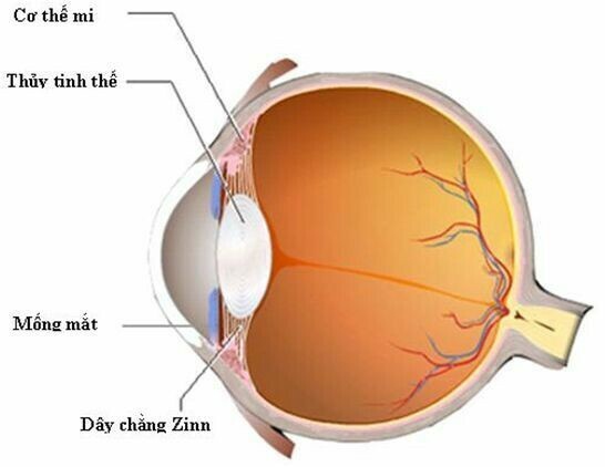 Thủy tinh thể (Nguồn: Y học trực tuyến)