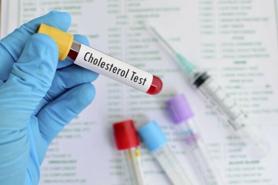  Bạn nên xét nghiệm để theo dõi cholesterol máu định kỳ. Nguồn ảnh: https://www.diabetes.co.uk/