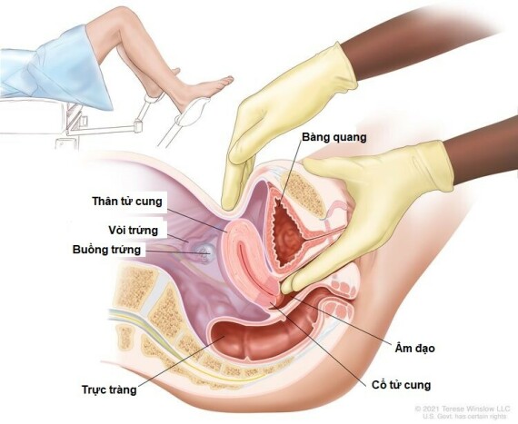 Khám vùng chậu: Một bác sĩ hoặc y tá đưa một hoặc hai ngón tay đeo găng, được bôi trơn của một bàn tay vào âm đạo và dùng tay kia ấn vào bụng dưới. Điều này được thực hiện để cảm nhận kích thước, hình dạng và vị trí của tử cung và buồng trứng. Âm đạo, cổ tử cung, ống dẫn trứng và trực tràng cũng được kiểm tra.