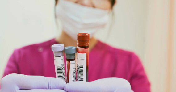 Blood tests: Types, routine testing, results, and moreNguồn: medicalnewstoday.com