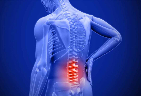 Đau lưng là triệu chứng hay gặp trong VCSDK  https://www.pinterest.com