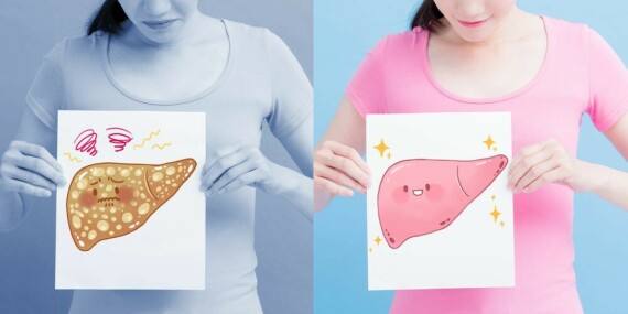 Fatty Liver: Causes, Symptoms, Do's and Dont's, and Diet Plan