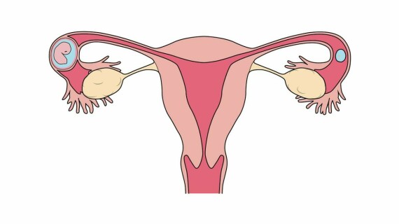 Thai làm tổ không đúng vị trí (Nguồn ảnh: Planned Parenthood)