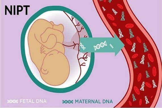 Xét nghiệm NIPT được thực hiện trên cơ sở phân tích những đoạn DNA tự do có trong máu của mẹ