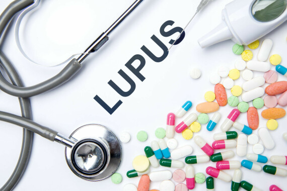 Lupus không thể được điều trị khỏi hoàn toàn nhưng có thể điều trị cải thiện triệu chứng. (Nguồn ảnh: practicalpainmanagement.com)