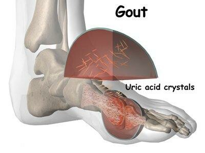 Nguồn ảnh: orthogate.org