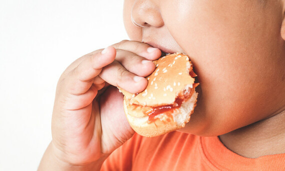 Dư thừa calo là nguyên nhân chủ yêu của béo phì, Nguồn ảnh: VnExpress International