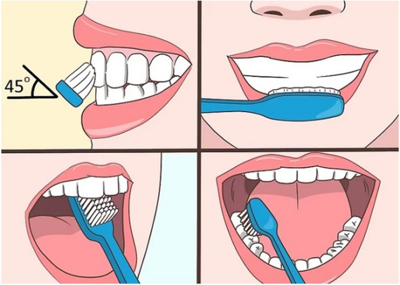 Hãy đánh răng 2 lần mỗi ngày trong ít nhất 2 phút với bàn chải ở góc 45 độ so với răng của bạn, đảm bảo chải hoàn toàn từng mặt của mỗi răng. (nguồn: missionimplancenter.com)