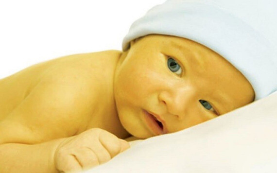 Biến chứng thường xuyên gặp ở trẻ sinh non là vàng da sinh lý. Nguồn ảnh: Pinterest