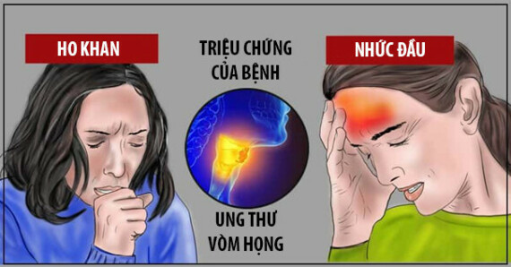 Các triệu chứng và dấu hiệu ban đầu của ung thư vòm họng