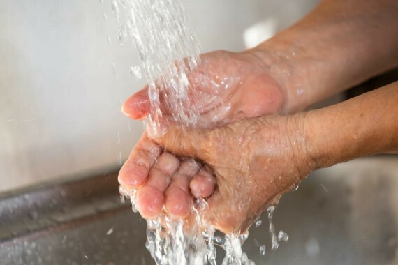 Để da dưới nước mát ít nhất 10 phút có thể giúp điều trị bỏng.  Nguồn ảnh: printerest.com