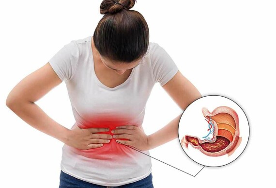 Sử dụng thuốc Codurogyl có thể gây ra tình trạng đau dạ dày