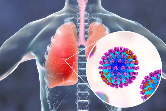 Alpenam được chỉ định trong điều trị viem phổi do vi khuẩn nhạy cảm gây ra