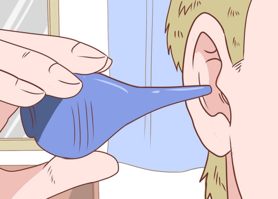 Rửa tai giúp loại bỏ ráy tai. Nguồn ảnh: wikihow