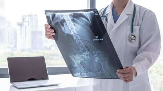 Phim X-quang bụng thường được chỉ định trong tắc ruột. Nguồn ảnh: news.delaware.gov