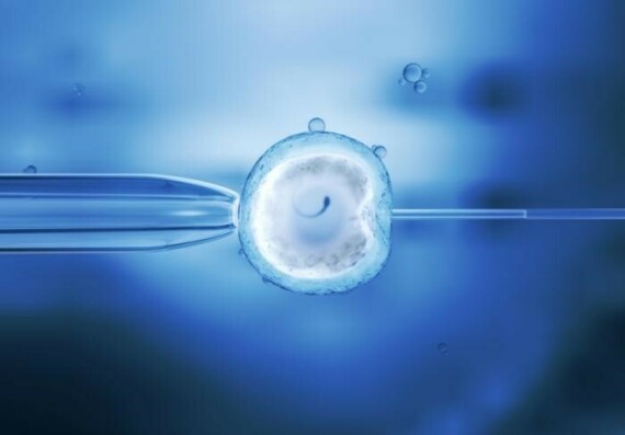 Hình 3. Phương pháp thụ tinh trong ống nghiệm IVF (Nguồn: medicalnewstoday.com)