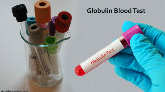 Xét nghiệm nồng đôh globulin (nguồn: https://www.healthcheckup.com/)