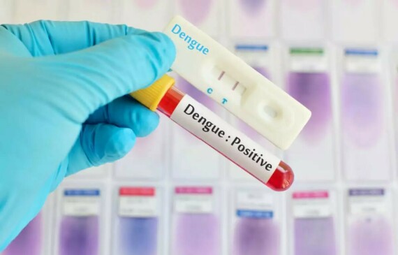 Kết quả xét nghiệm NS1 dương tính cho thấy bệnh nhân đã nhiễm virus Dengue. Nguồn ảnh: health.economictimes.indiatimes.com