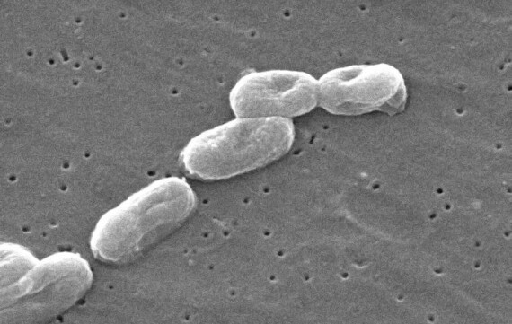 Vi khuẩn Burkholderia Cepacia (Nguồn ảnh: Wikipedia)