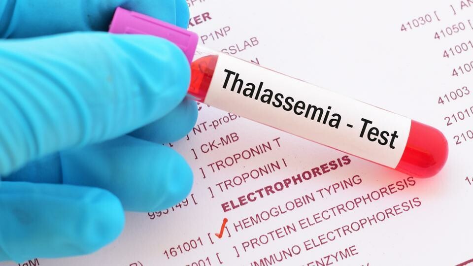 Khám tiền sản để dự phòng nguy cơ truyền bệnh cho thế hệ sau như bệnh máu khó đông,Thalasemia (nguồn ảnh: https://www.hindustantimes.com/)