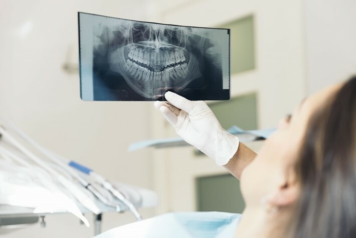 Để biết chính xác tình trạng gây ê buốt răng, bác sĩ có thể chỉ định chụp phim X-quang răng.  Nguồn ảnh: oceanbreezedental.com